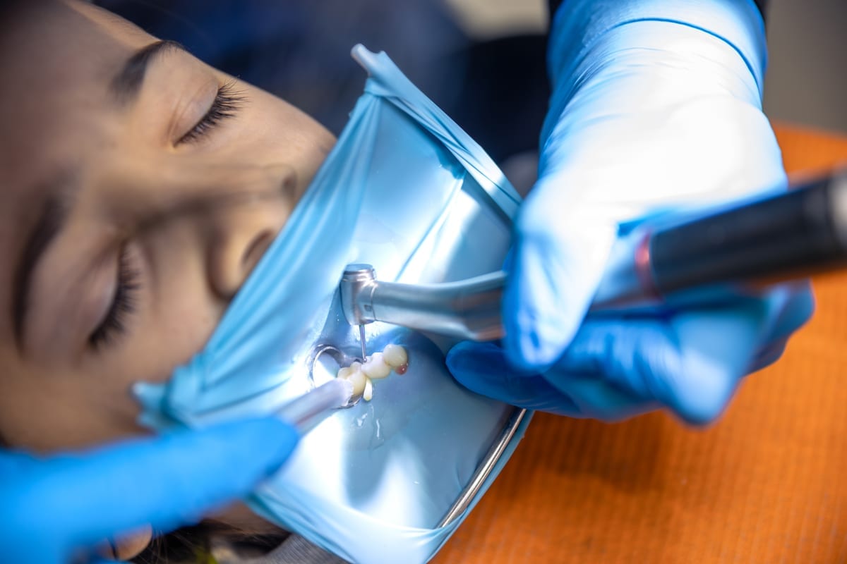 Root Canal Treatment in Holmdel